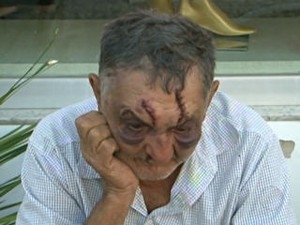 Suspeito de desfigurar rosto de idoso de 74 anos é preso na BA
