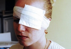 Mulher faz cirurgia após lesão no olho