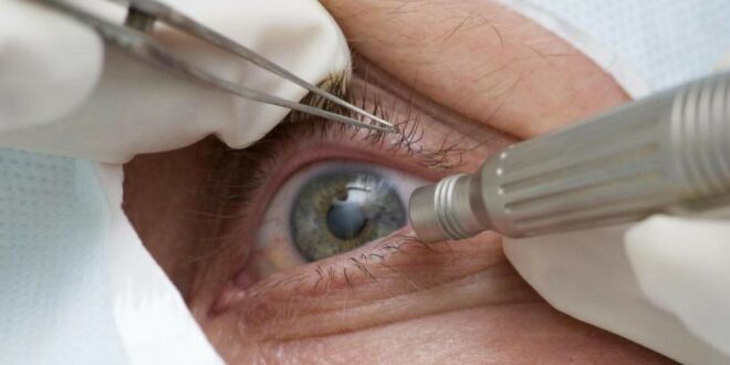 Consultas regulares ao médico podem afastar risco de glaucoma