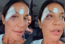 Ivete Sangalo recebe alta após desmaiar e ser internada em Salvador