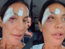 Ivete Sangalo recebe alta após desmaiar e ser internada em Salvador