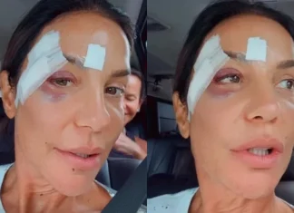 Ivete Sangalo recebe alta após desmaiar e ser internada em Salvador