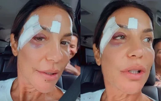 Ivete Sangalo recebe alta após desmaiar e ser internada em Salvador