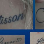 Mulher é forçada a tatuar nome de dentista e caso choca