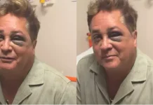 Leonardo revela fratura no rosto após acidente em pescaria