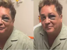 Leonardo revela fratura no rosto após acidente em pescaria