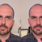Bolsomaster: Casa de Eduardo Bolsonaro nos EUA é ligada a recursos de Vorcaro, diz ativista