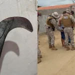 Jovem tem mãos reimplantadas após ataque brutal em tentativa de feminicídio