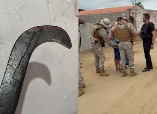 Jovem tem mãos reimplantadas após ataque brutal em tentativa de feminicídio