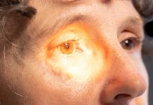 Uso indiscriminado de corticoides pode causar glaucoma e cegueira