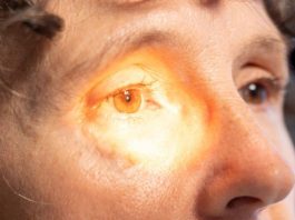 Uso indiscriminado de corticoides pode causar glaucoma e cegueira