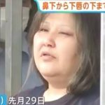 Mulher é presa no Japão suspeita de costurar lábios de colega de quarto