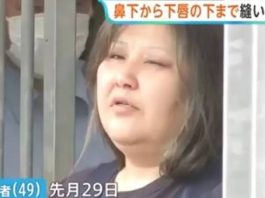 Mulher é presa no Japão suspeita de costurar lábios de colega de quarto