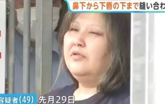 Mulher é presa no Japão suspeita de costurar lábios de colega de quarto