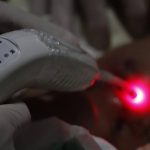 Laserterapia fortalece a Atenção Primária e amplia a qualidade do atendimento gratuito em Alta Floresta