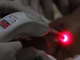 Laserterapia fortalece a Atenção Primária e amplia a qualidade do atendimento gratuito em Alta Floresta