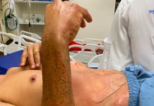 Homem de 55 anos fica ferido após sofrer descarga elétrica em MT