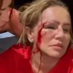 Vereadora do PT é ferida em ataque a carreata em Minas Gerais